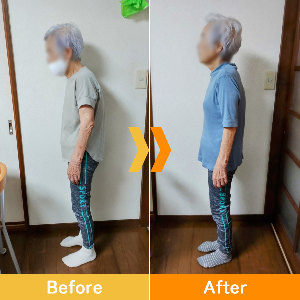 85歳 女性 T様