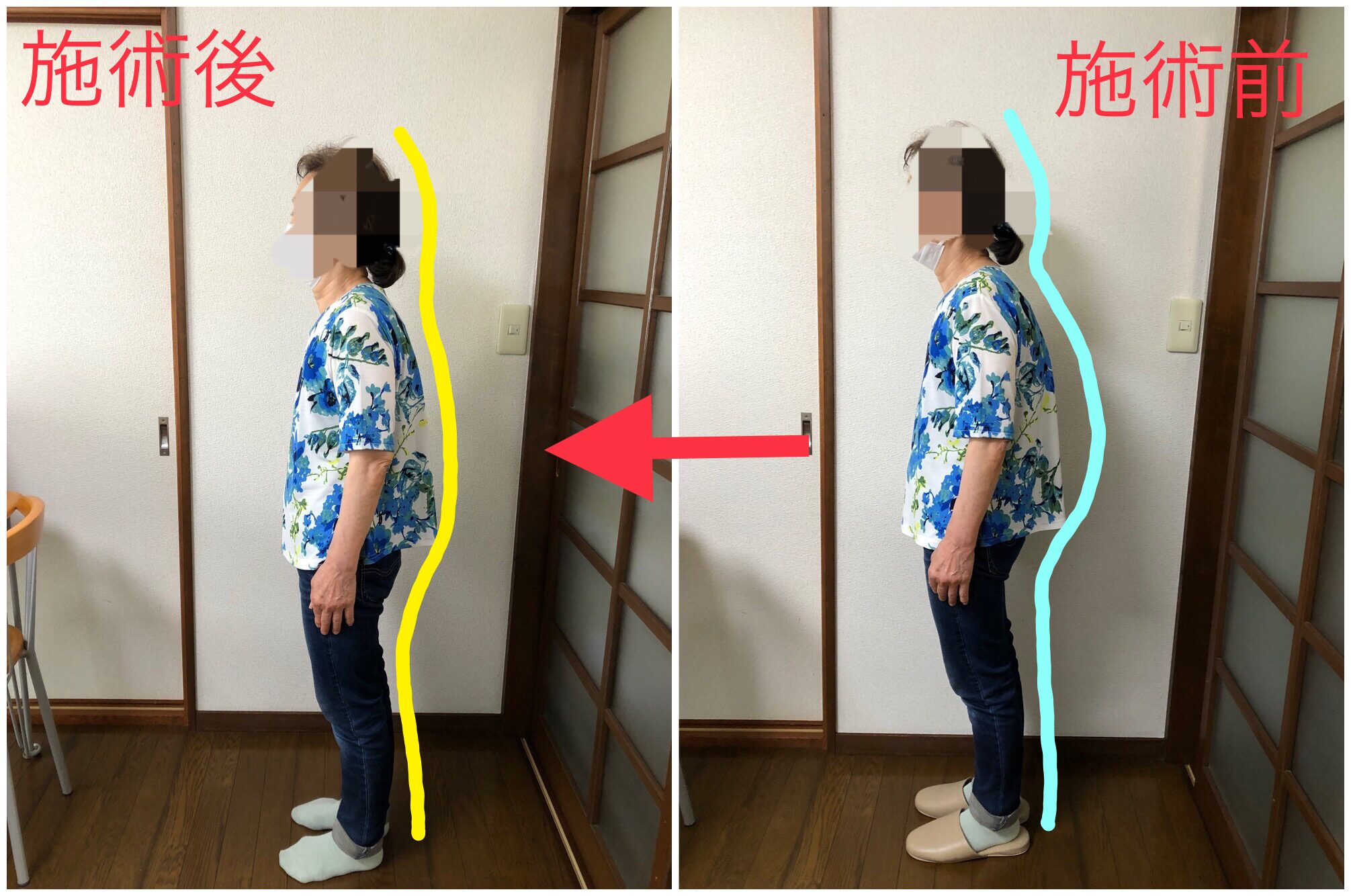 70代・女性 S様