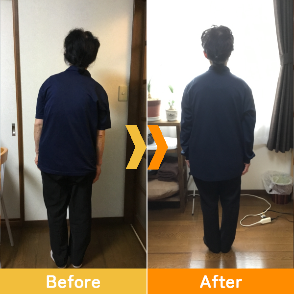 C様 70代女性